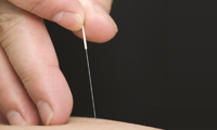 acupuncture